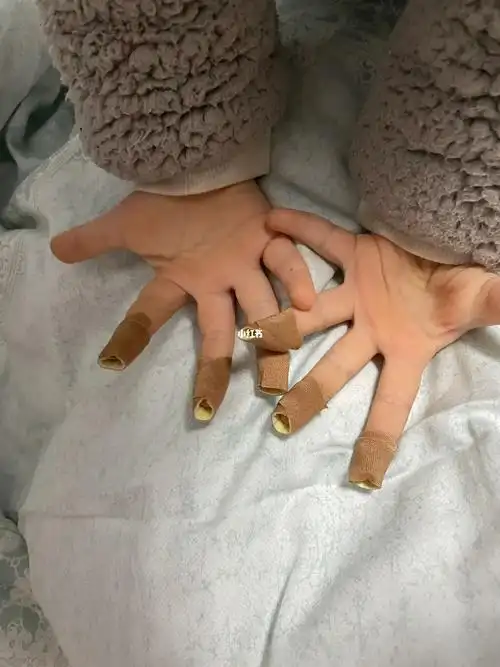 她不咬了,放学回来指甲又是秃秃的,一问她才知道在学校睡觉又啃了miss