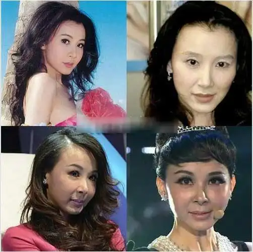 大s袁珊珊angelababy 女星整容惨败照|明星整容失败|明星整容|angela