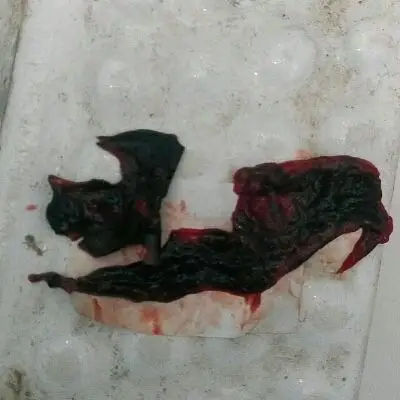 问答 准备怀孕 123haiqi海齐还没有宝宝2016-07-31 推荐回答