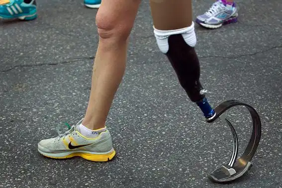 优邦假肢腿部假肢调试技巧