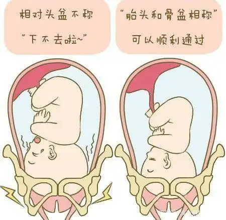 胎儿足月本应入盆,但迟迟没有入盆的动静,有可能跟3个原因有关