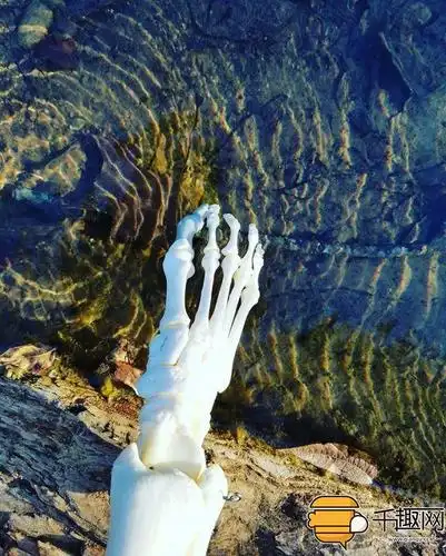 罕病女忍痛截肢竟把右腿脚骨制作成标本天天自拍