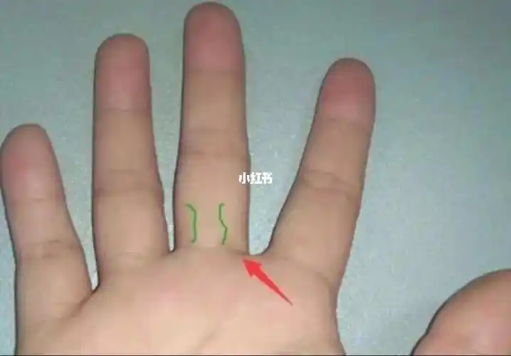 脑血管疾病的手诊部位是"头区",即中指近手掌一侧的整个指节,头区有三