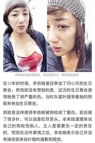 李依晓整容甩锅叶璇?