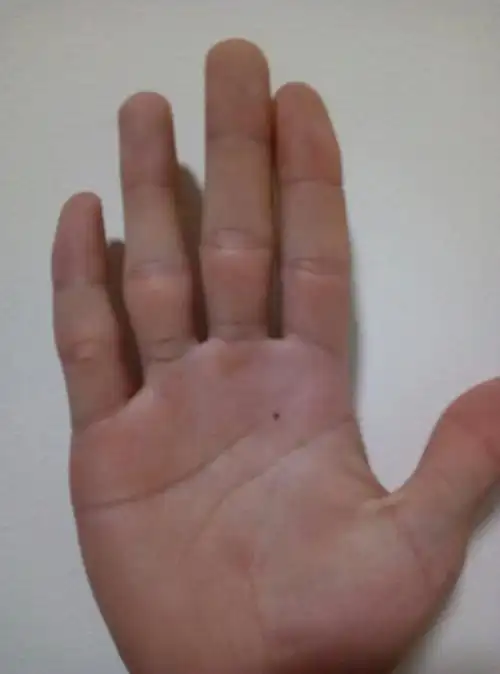 男生右手感情线旁边有颗痣是什么意思?