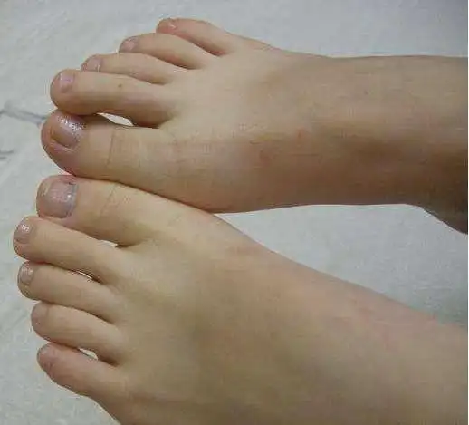 每天用它泡一泡,脚丫白嫩又光滑,还免花大钱!