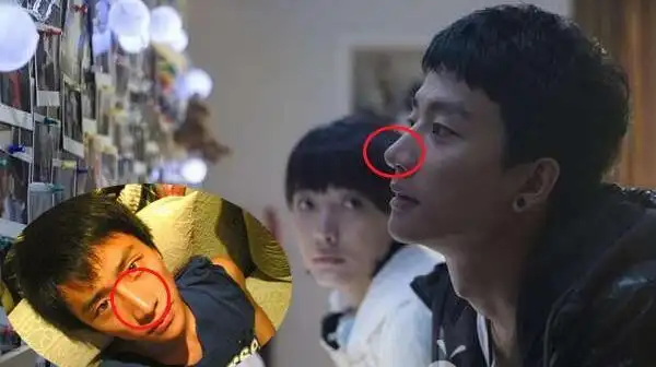 黄轩单眼皮被玩坏了,揭秘黄轩整容是真是假