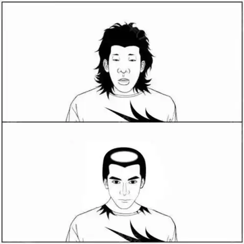 秃顶帅哥vs浓密丑男你会选择谁.[:_圈子-新氧美容整形