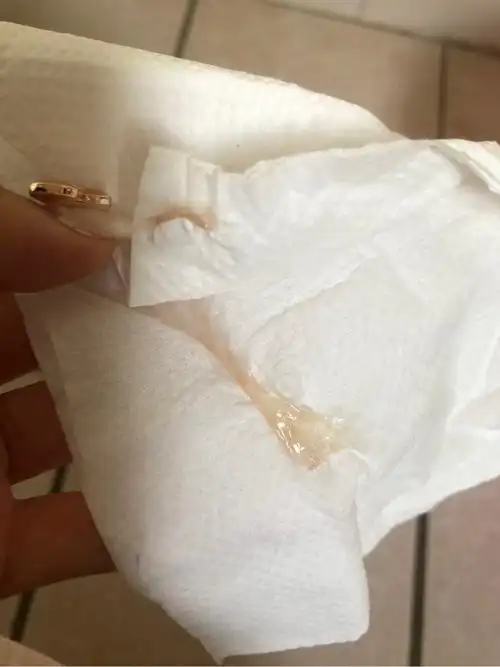 今天是排卵期的最后两天,昨晚喝多了,跟男朋友搞了,好像射肚子了,后面