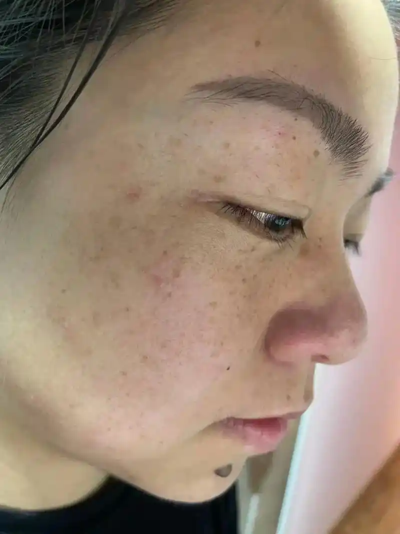 本人为了体验效果亲自打版, 从一脸的斑斑点点,皮肤暗沉 到现 - 抖音