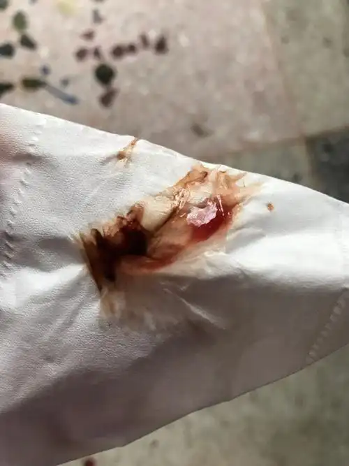 生完宝宝九个多月,下面像有白带样血丝怎么回事?