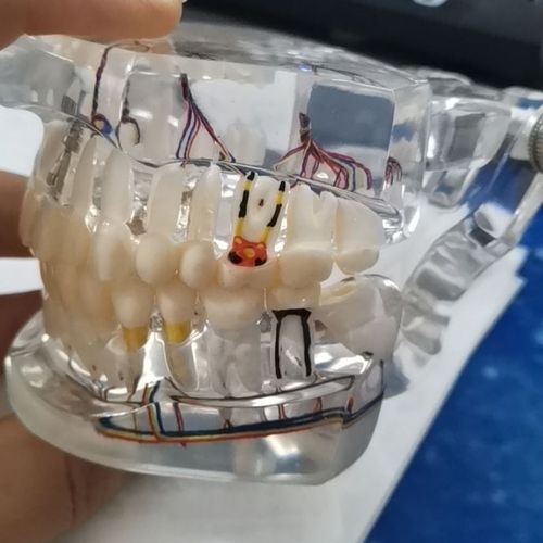 牙科教学模型 牙齿模型 牙模型 成人病理 医患沟通模型带神经牙模