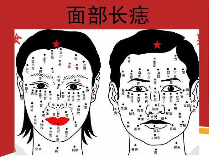 面部长痣