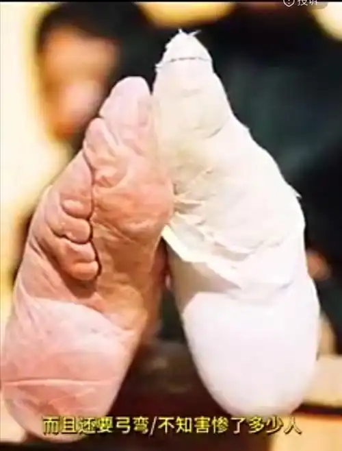 说说裹脚