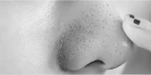 深层清洁才是王道!奢悦活颜净肌清洁面膜