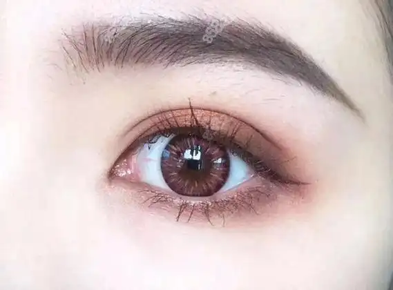 双眼皮二次修复成功率