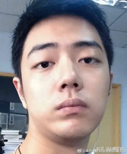 有没有肖战的丑照