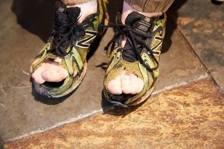 鞋臭到呛鼻流眼水