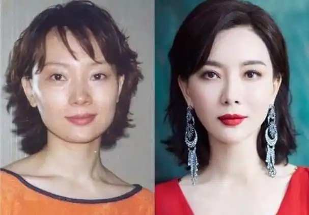 陈数是圈内整容最成功的女星之一,整容前后简直就像是换了个人一样.