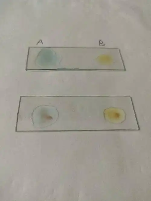 请问我是什么血型啊(我不懂凝集的具体概念)所以分不清自己是ab还是o