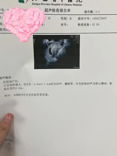 终于接到了热乎的胎心胎芽