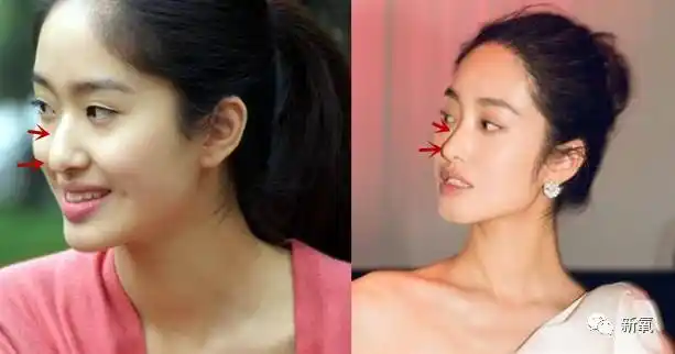 杨采钰自曝曾被哥伦比亚大学戏剧系录取刘亦菲脸被打肿