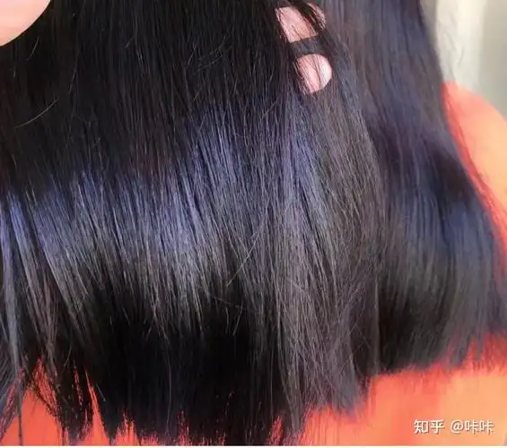 油性发质而且掉头发一般一天洗一次头发用什么洗发水比较好