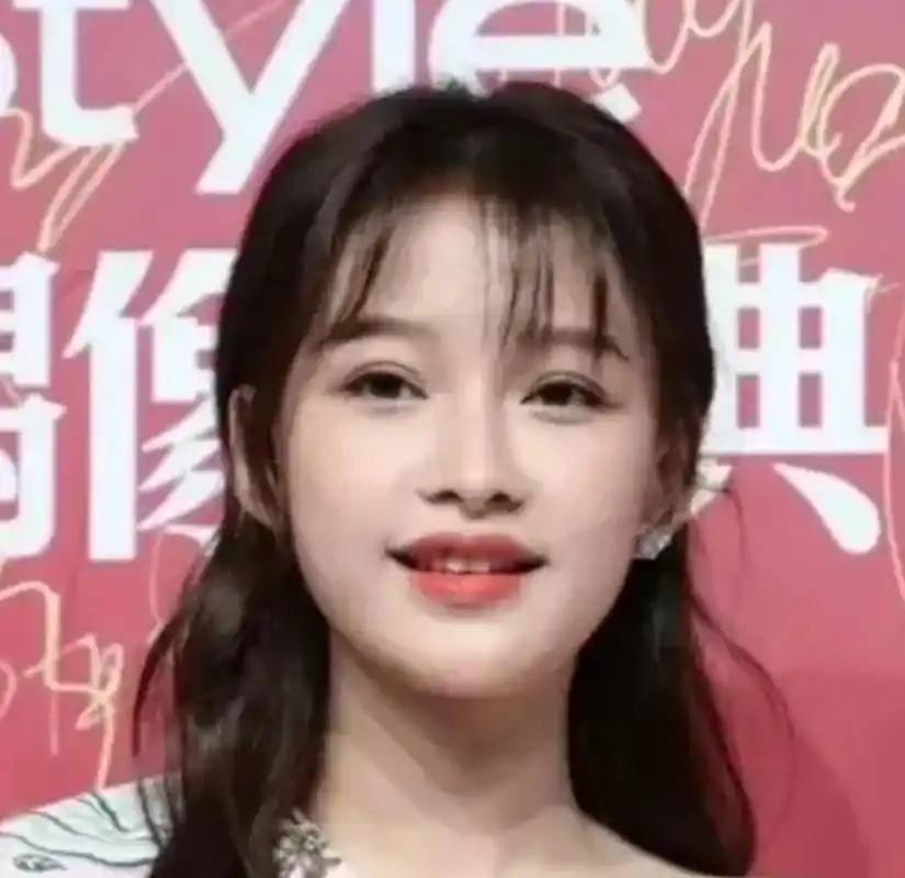 孙怡是整了双眼皮吗?感觉之前的眼睛更漂亮