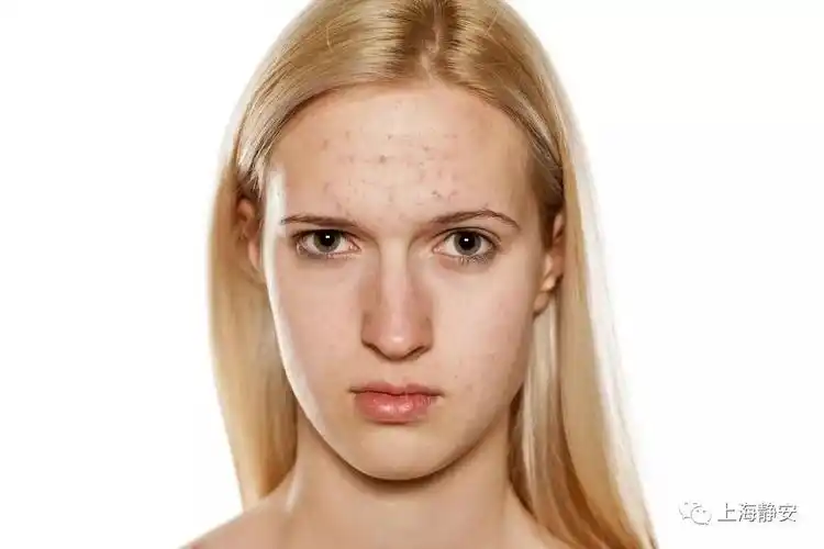 难怪你便秘,皮肤差,太多人中招了!