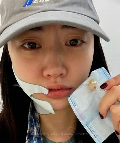 33岁景甜晒拔牙照,还穿高腰短裙秀大长腿,网友:姐素颜也好好看_照片