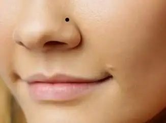 女人全身痣相图解【真人全身痣相图解】