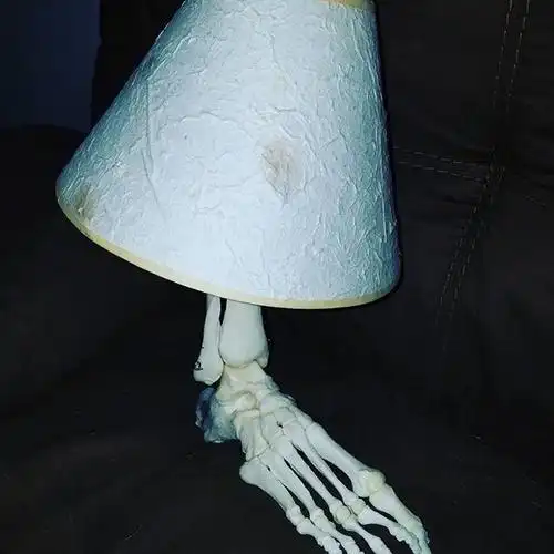 因癌症被截肢后 她和截掉的断脚成了自拍小伙伴