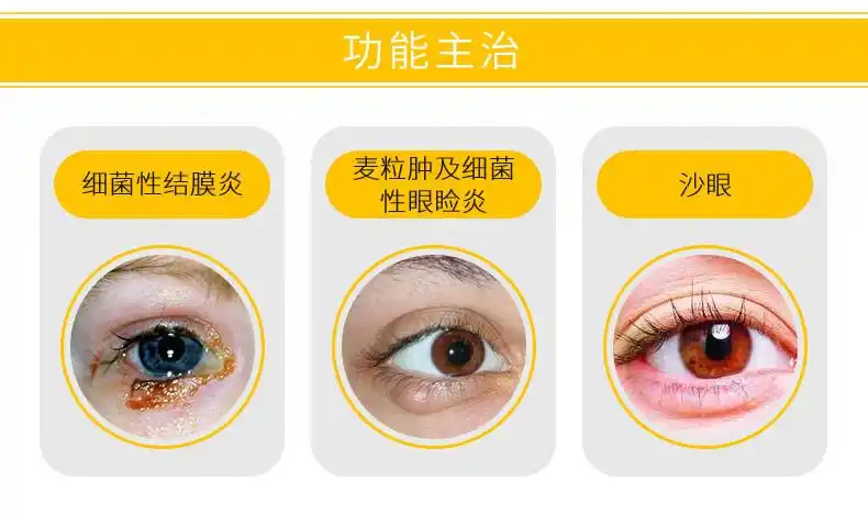 双吉盐酸金霉素眼膏清除去脂肪粒肿结膜炎眼睑炎沙眼药膏 10盒原品