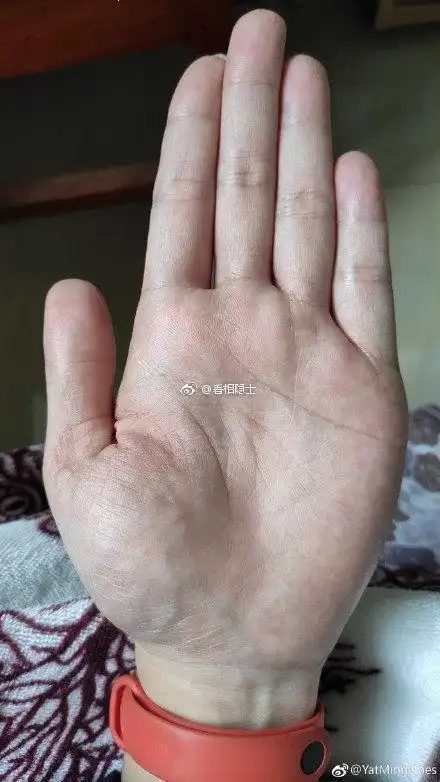 金星丘部位的青筋非常明显,生命线浅细薄弱. 来自动漫大部落 - 微博