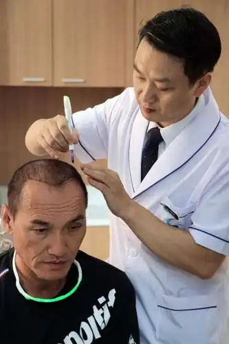 成都植发技术领先 香港tvb明星冼灏英赴蓉植发