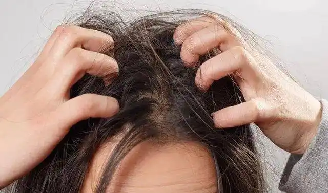 而且还会伤害到我们的头发会使我们头皮特别的痒