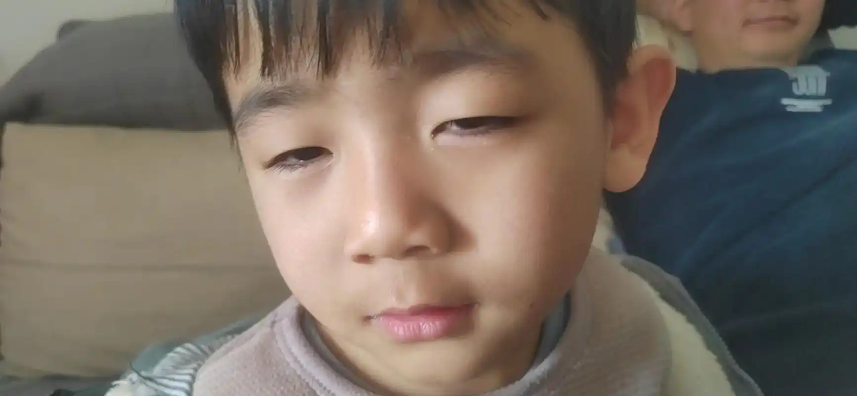 一直以为儿子是上眼睑下垂,差点没给他动手术(前三张照片),现 - 抖音