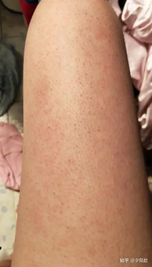 法 清洁是非常重要的,如果清洁都做不好皮肤会嗖嗖制造出一堆角质颗粒