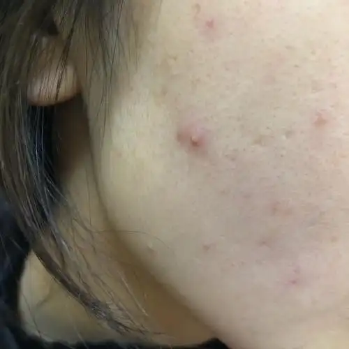 清颜世家问题性皮肤修复中心评论