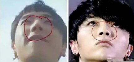 原创华晨宇被曝植发整容十年容貌变化对比锥子脸五官越来越精致