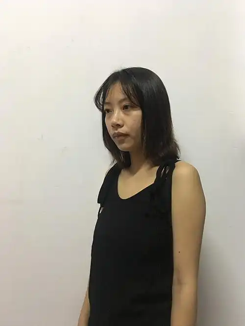 术前诊断这位求美者属于典型的青春期乳房发育不良,导_圈子-新氧美容