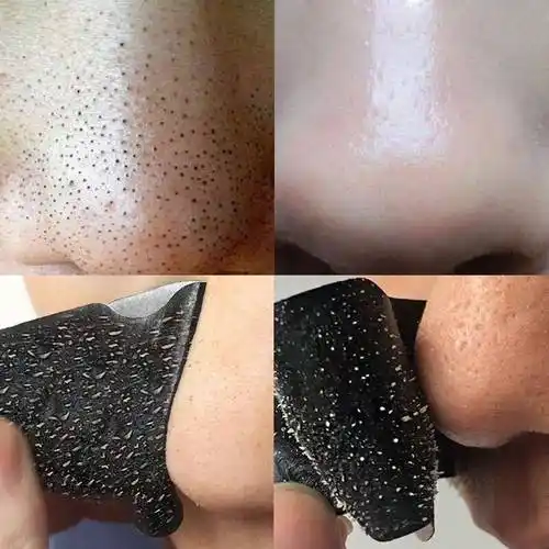 名称黑头贴属性鼻贴个性化去黑头鼻贴化妆品功效去黑头产品规格白色