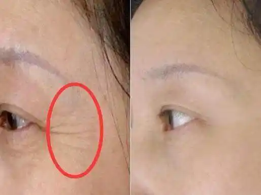 这个方法让皮肤水嫩细腻,不仅补水,还能增加皮肤弹性,去皱纹.