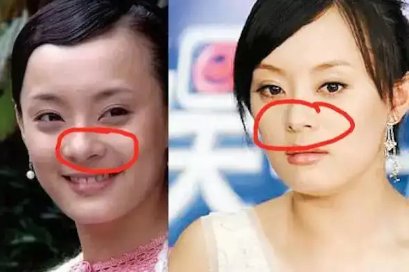 别以为这些女明星没整容 不然能比以前美这么多?