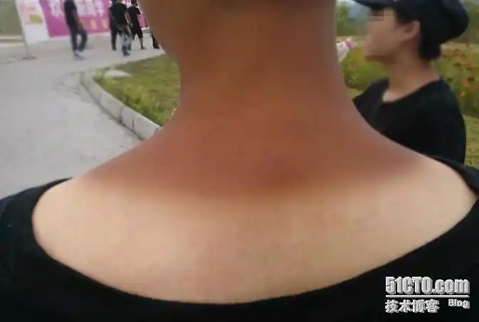 新学期新生军训,晒黑的mm怎么办?