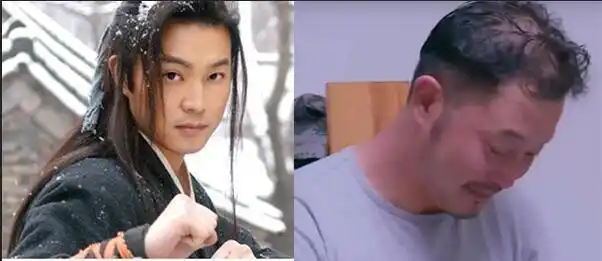 一秃毁所有,型男变大叔,男明星秃顶危机,不是谁都能秃成葛优的