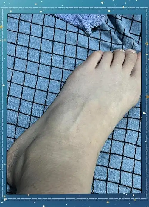 舞蹈生压脚背技巧全攻略