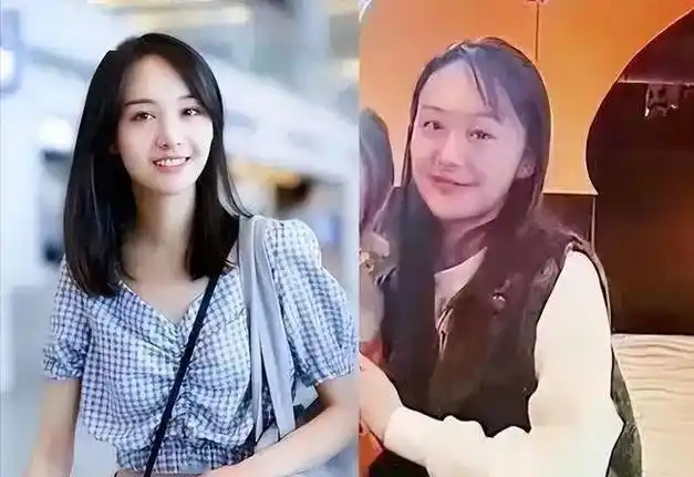 近日曝光的照片中,郑爽明显苍老,头发稀疏,面容憔悴.