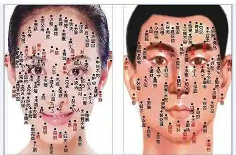 右边下巴有颗痣,左下巴的痣可以去掉吗