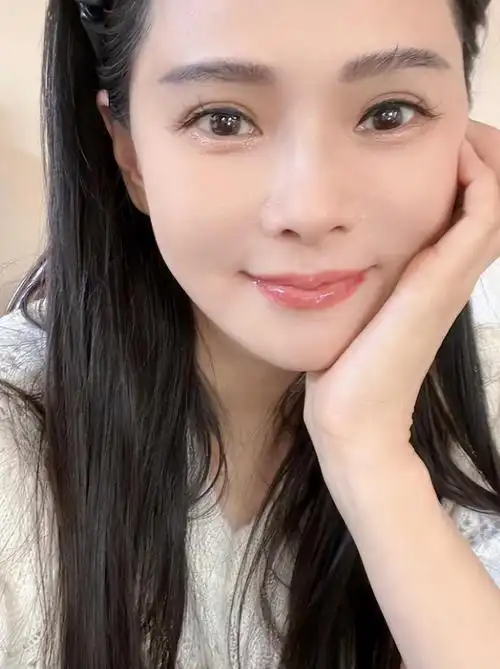 秦昊老婆跑韩国打水光针56岁伊能静满脸针眼感慨真的很痛